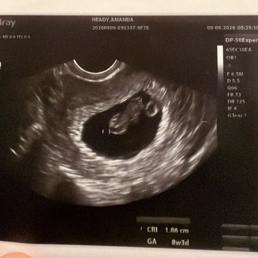 Photo shared by Amanda for their Babylist baby registry.