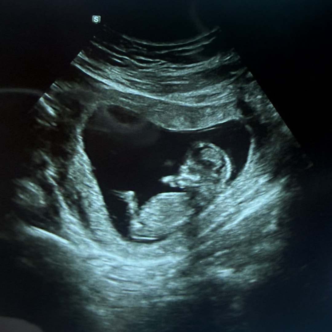 Photo shared by Jaqueline for their Babylist baby registry.
