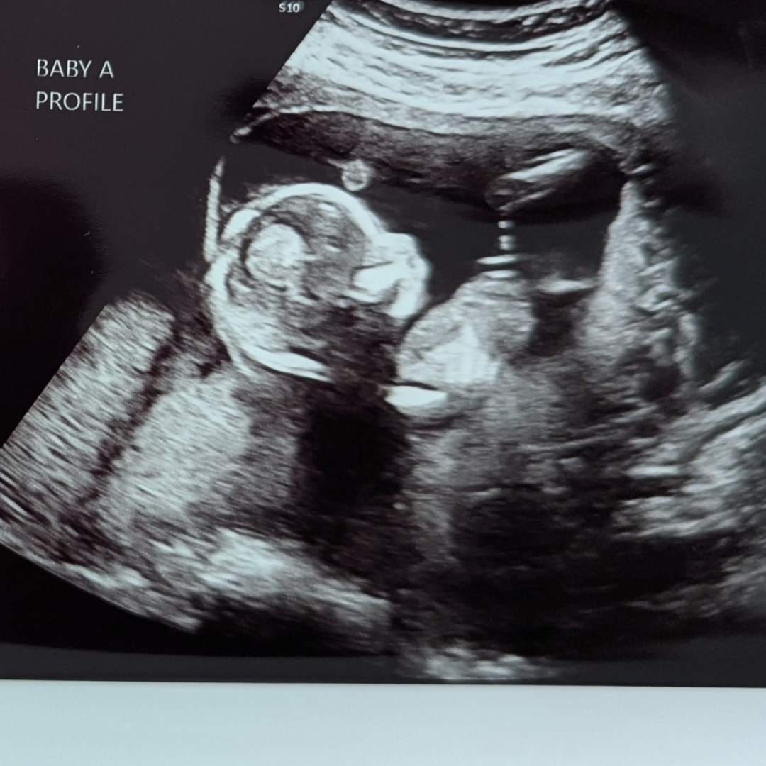 Photo shared by Heather for their Babylist baby registry.