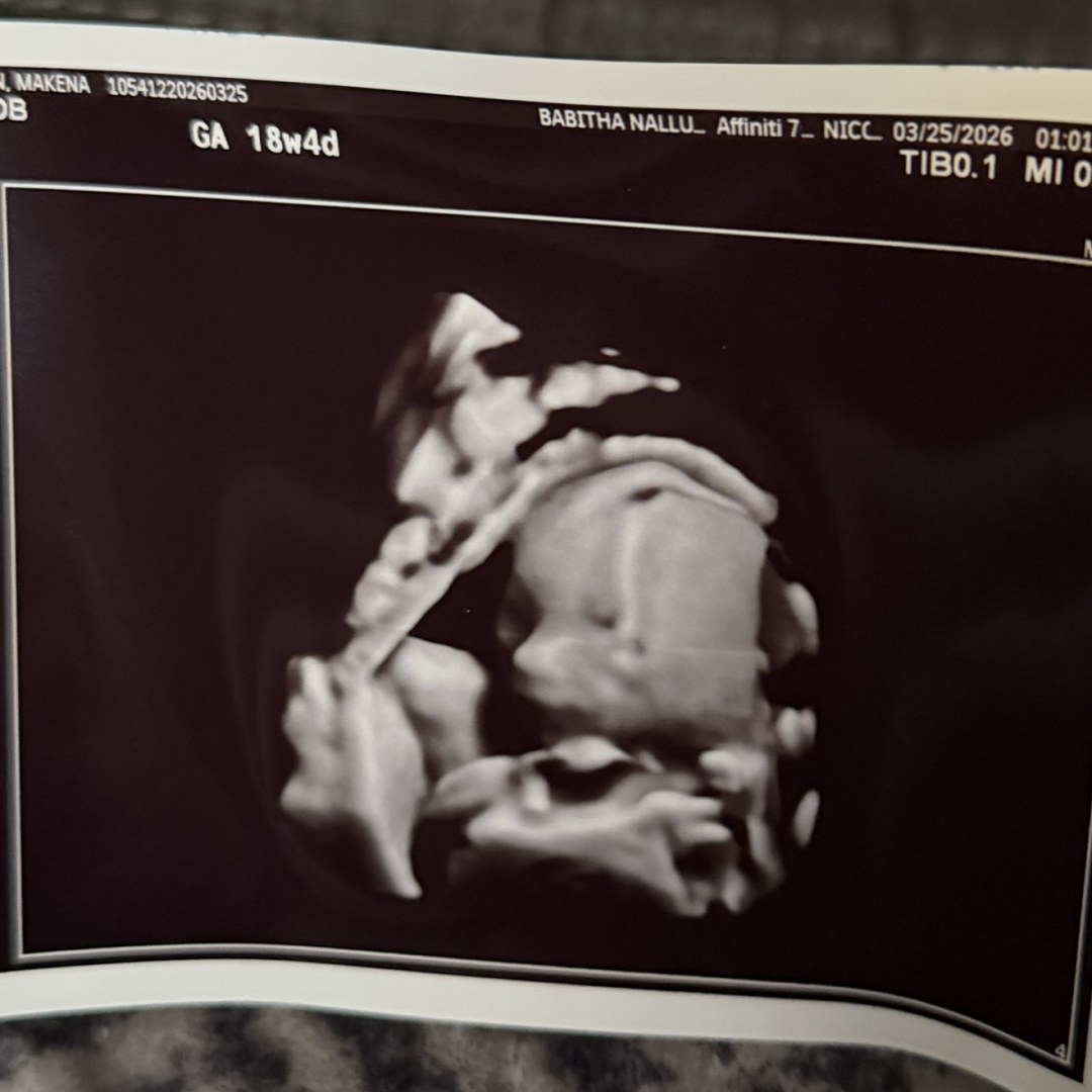 Photo shared by Makena for their Babylist baby registry.