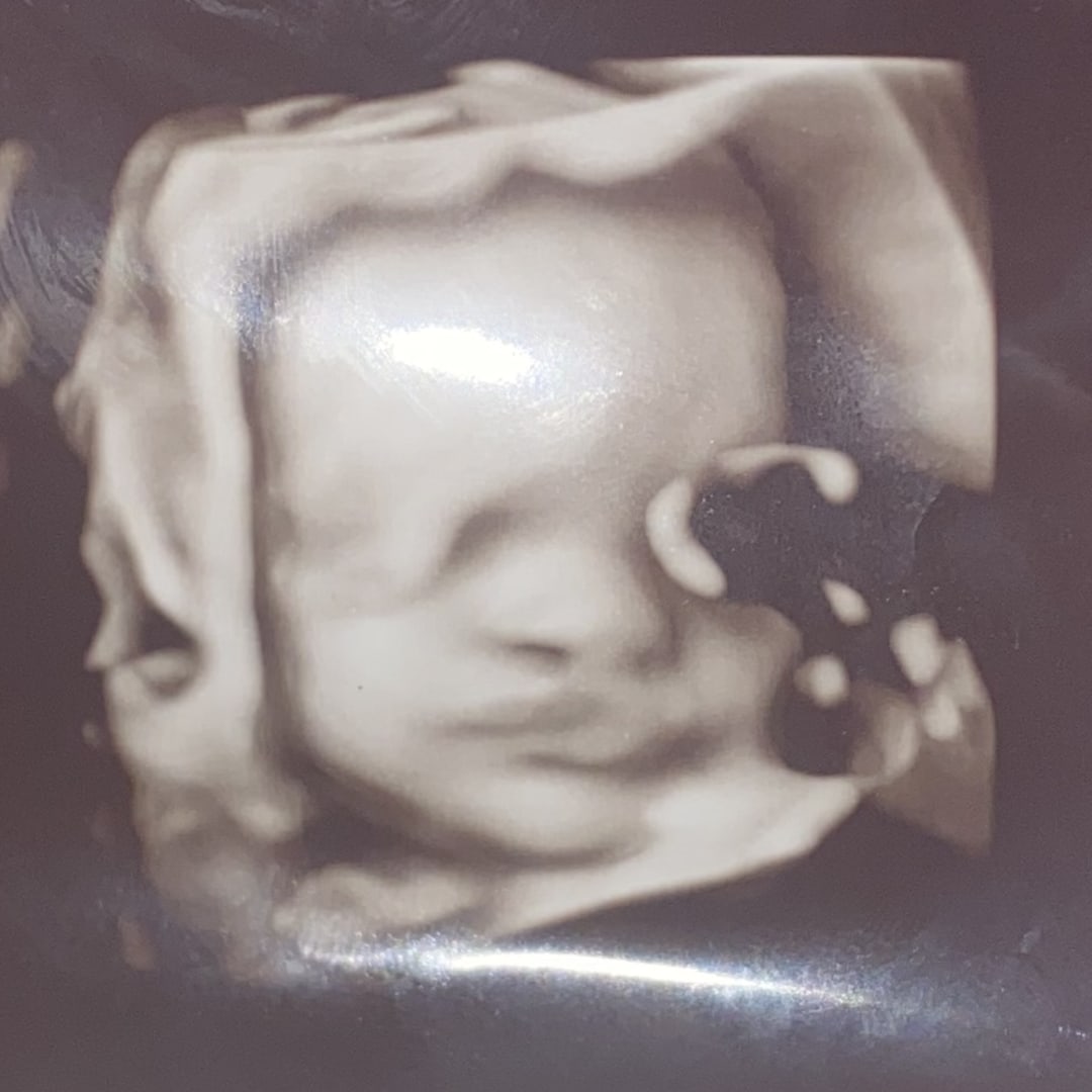 Photo shared by Ajanay for their Babylist baby registry.
