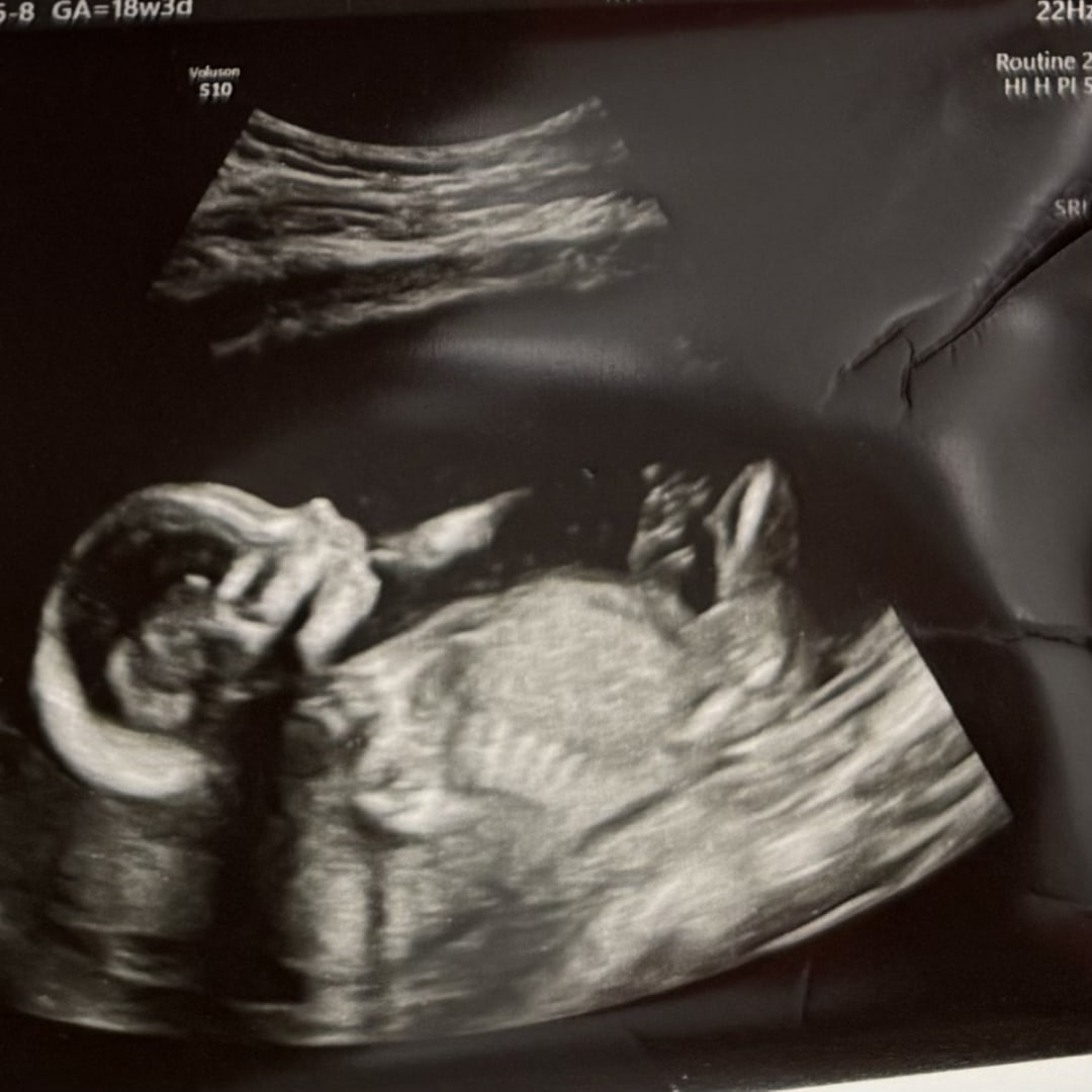 Photo shared by Jaclyn for their Babylist baby registry.