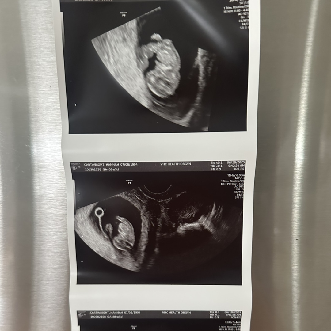 Photo shared by Hannah for their Babylist baby registry.