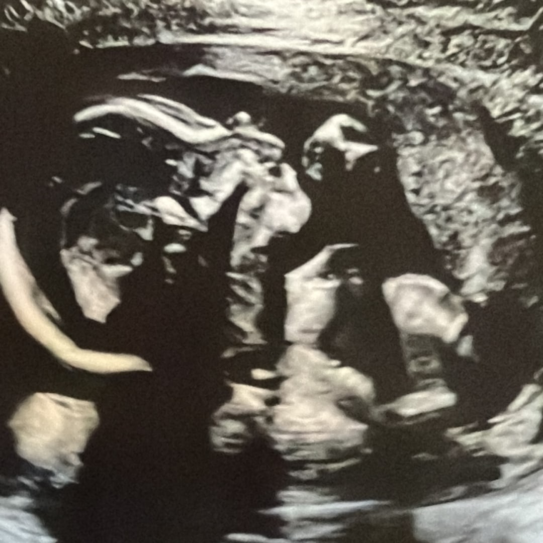 Photo shared by Michelle for their Babylist baby registry.