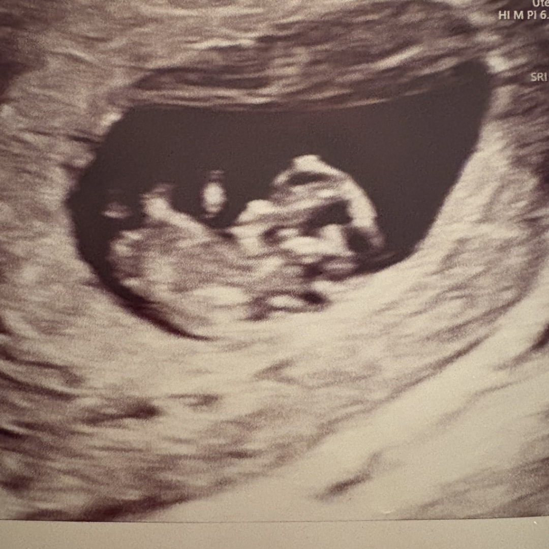 Photo shared by Kristi for their Babylist baby registry.