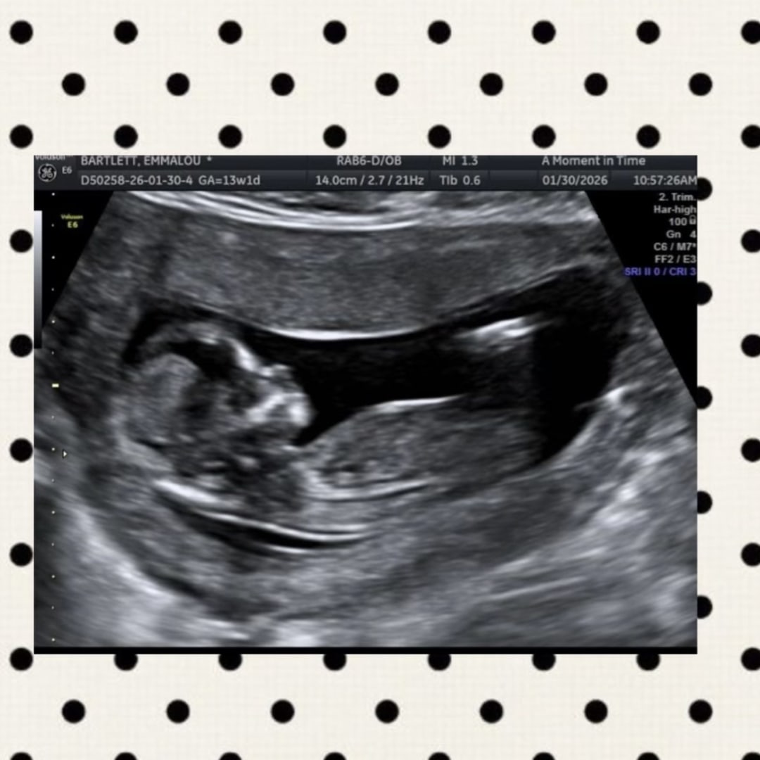 Photo shared by Emmalou for their Babylist baby registry.