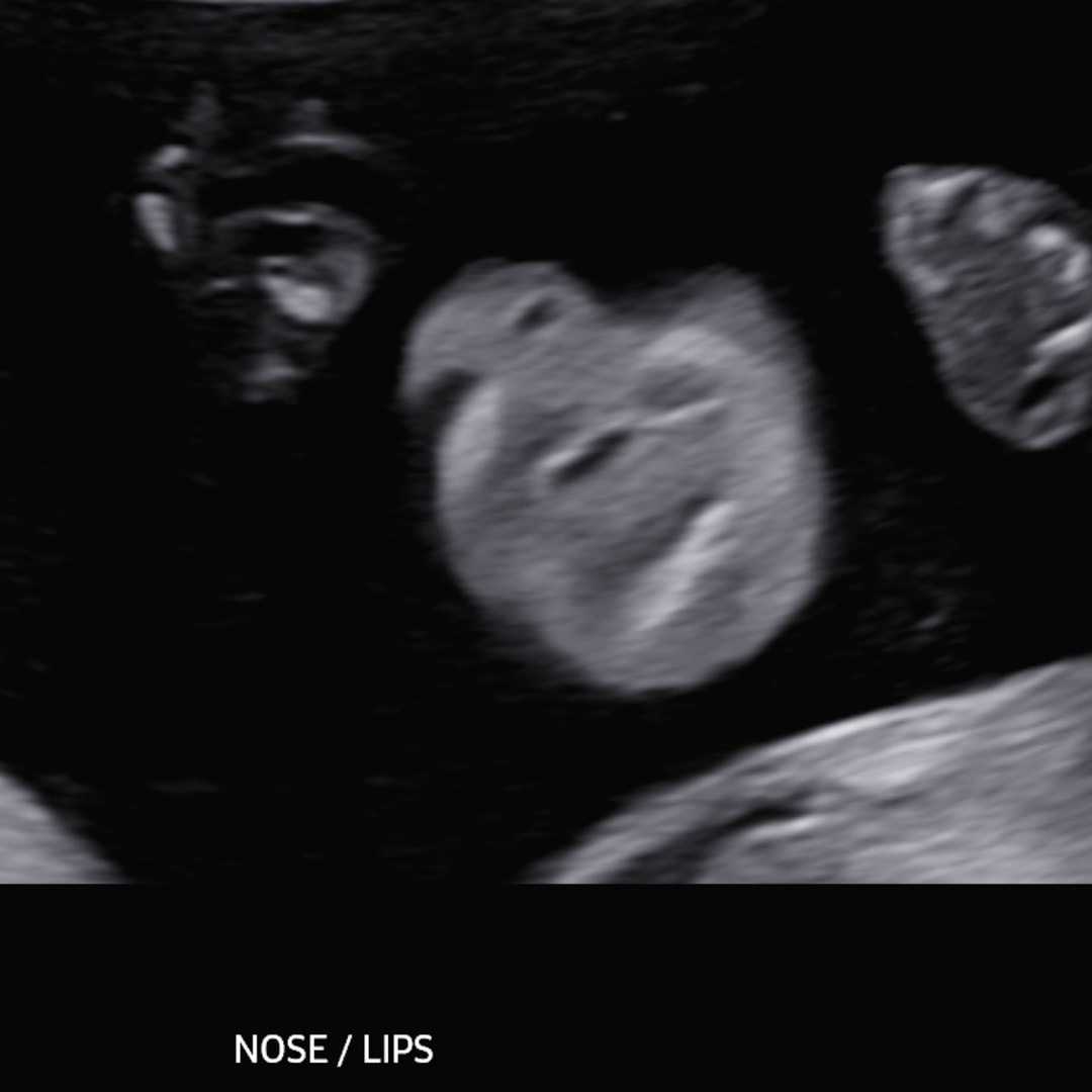 Photo shared by Josie for their Babylist baby registry.