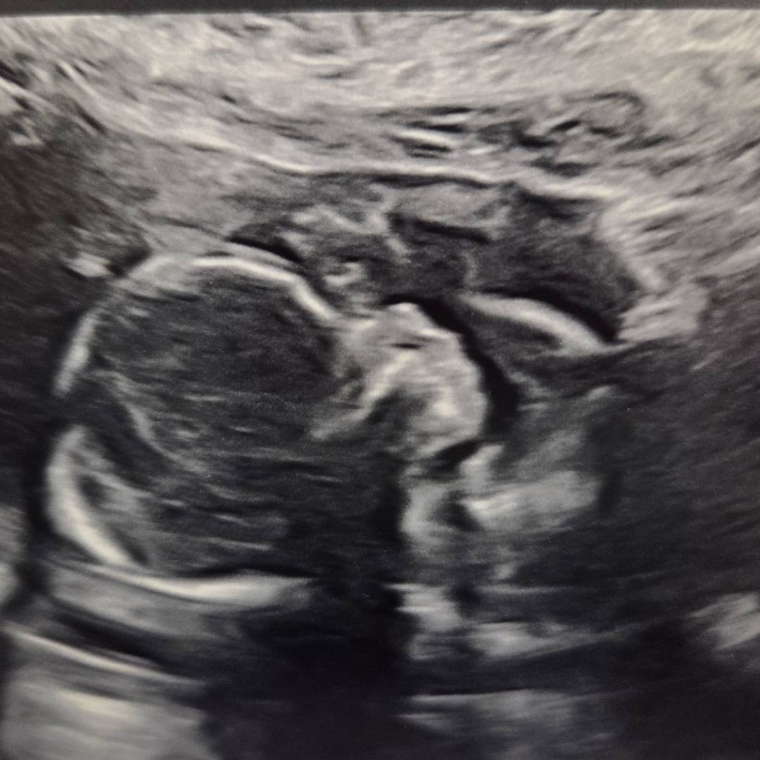 Photo shared by Mariah for their Babylist baby registry.