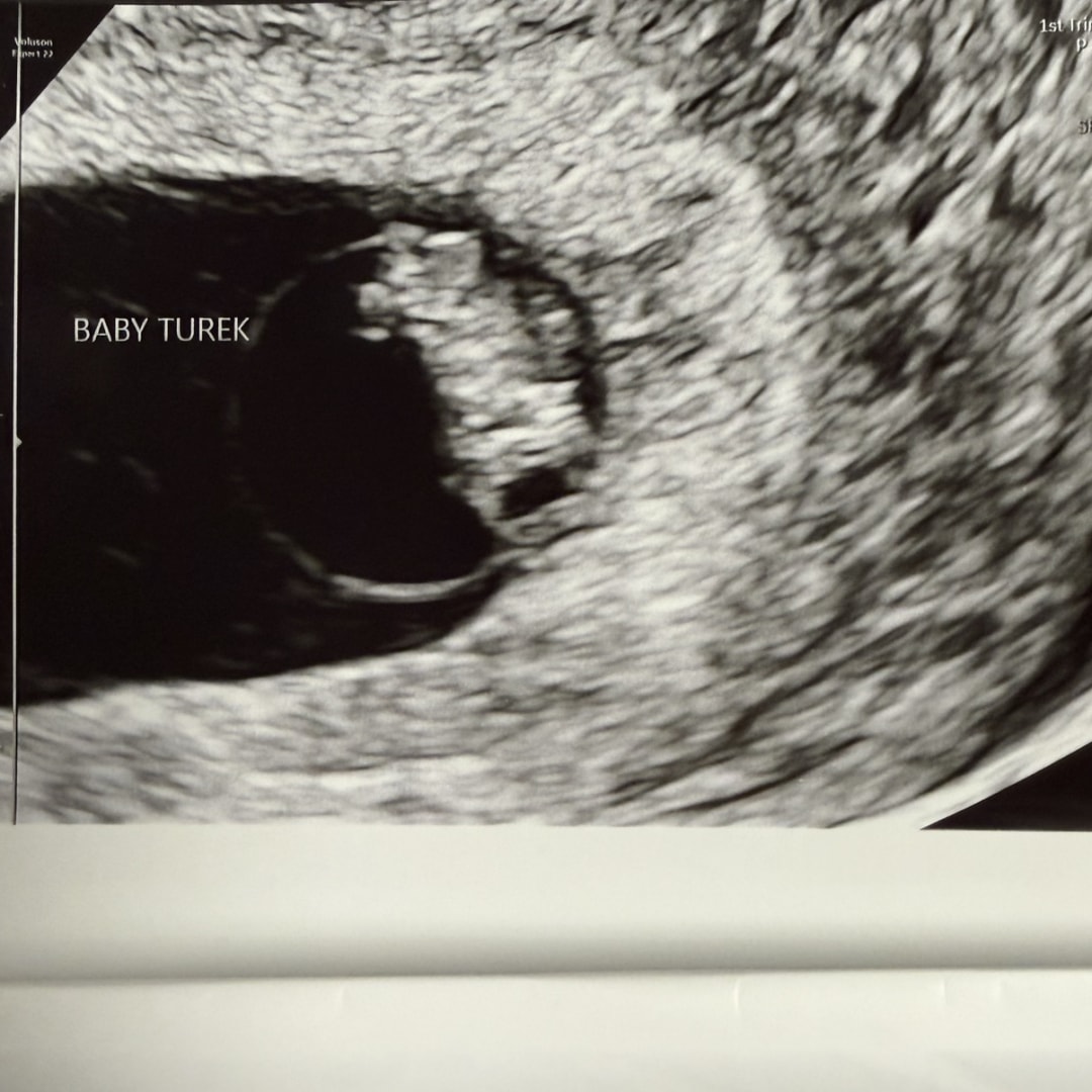 Photo shared by Lauren for their Babylist baby registry.