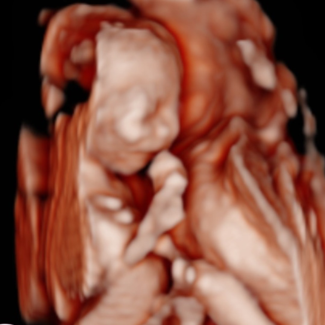 Photo shared by Alison for their Babylist baby registry.