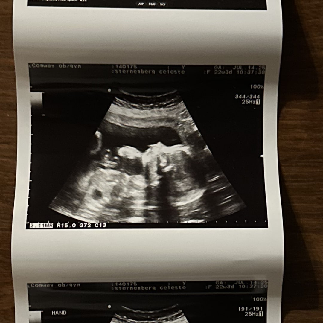 Photo shared by Celeste for their Babylist baby registry.