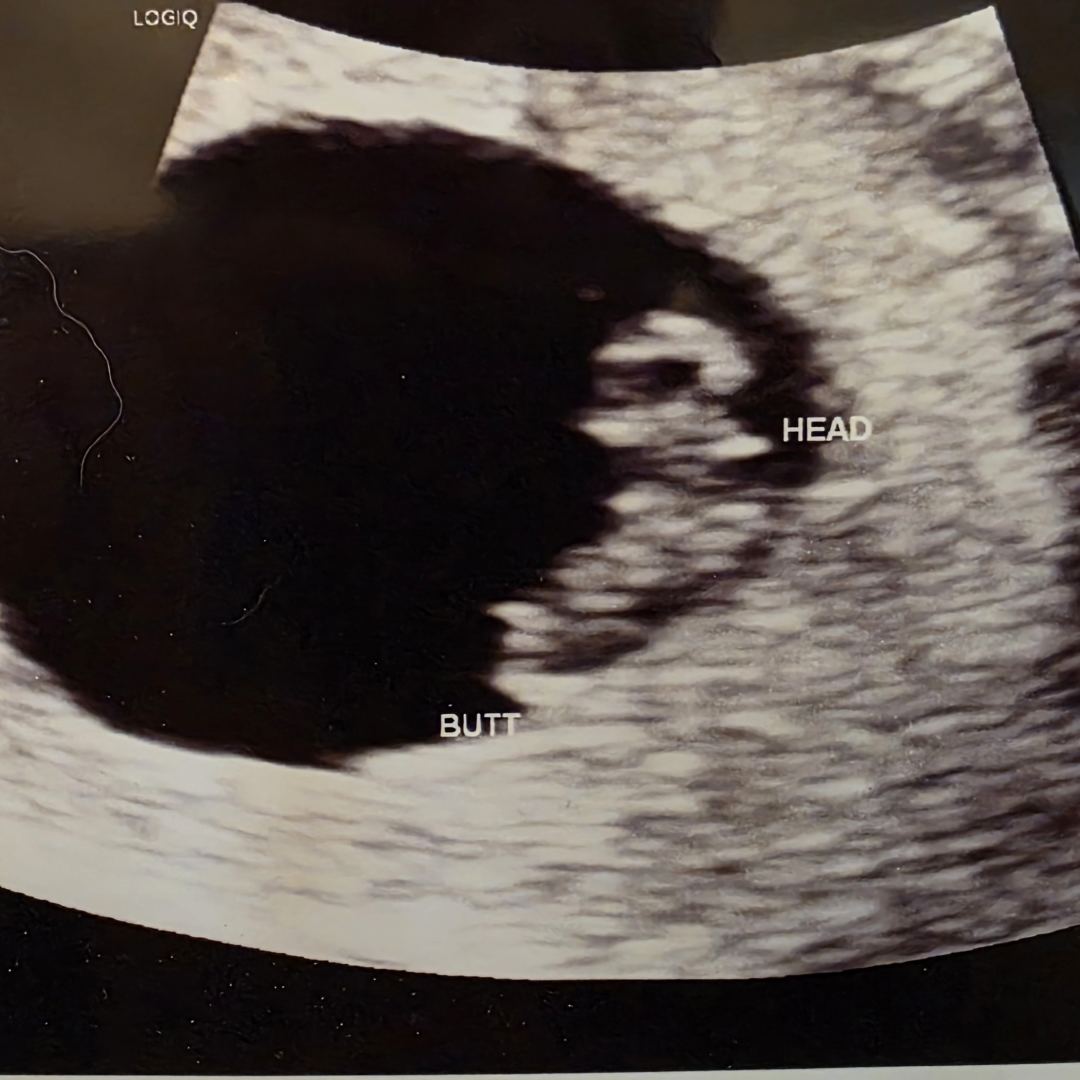 Photo shared by Alicia for their Babylist baby registry.