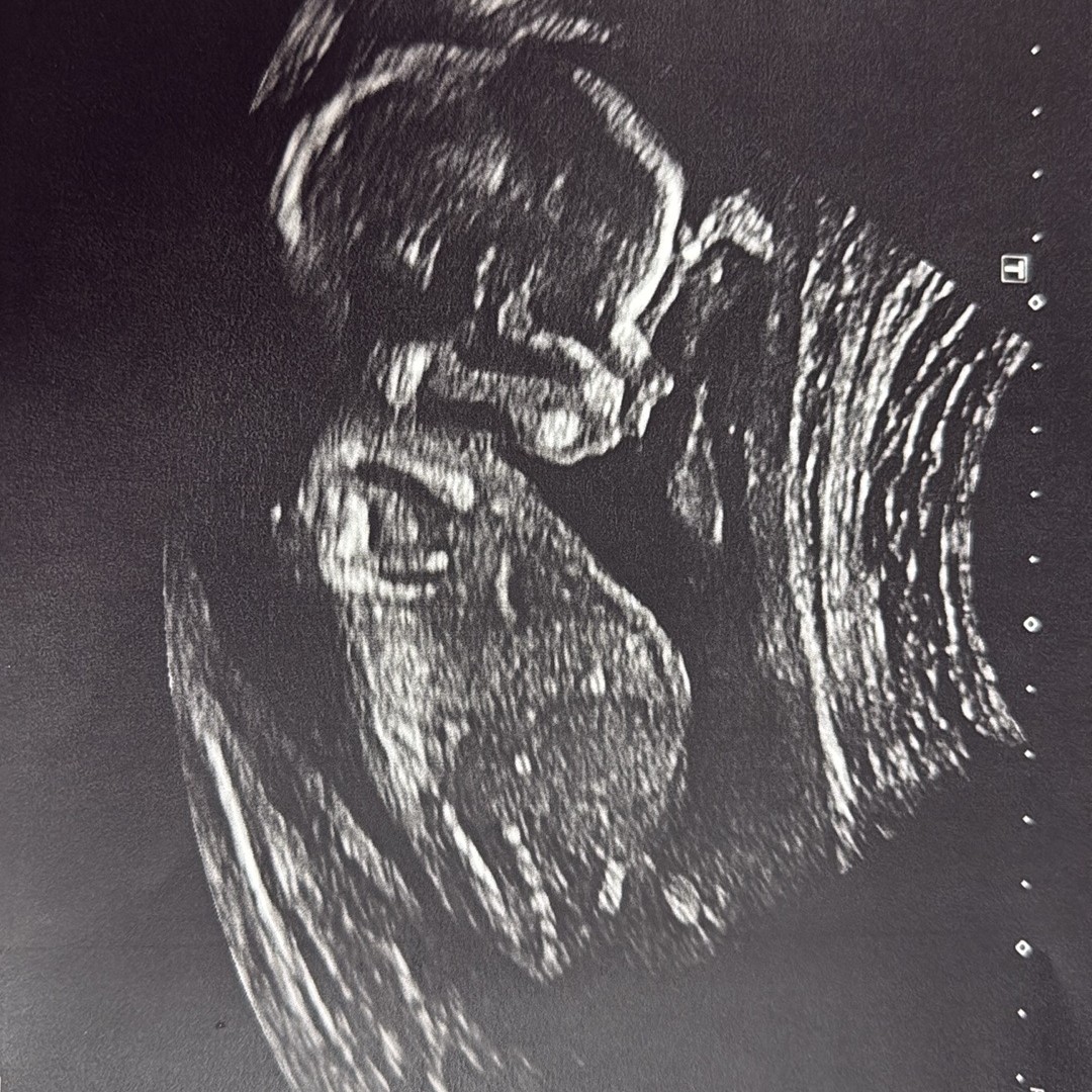 Photo shared by Joleah for their Babylist baby registry.