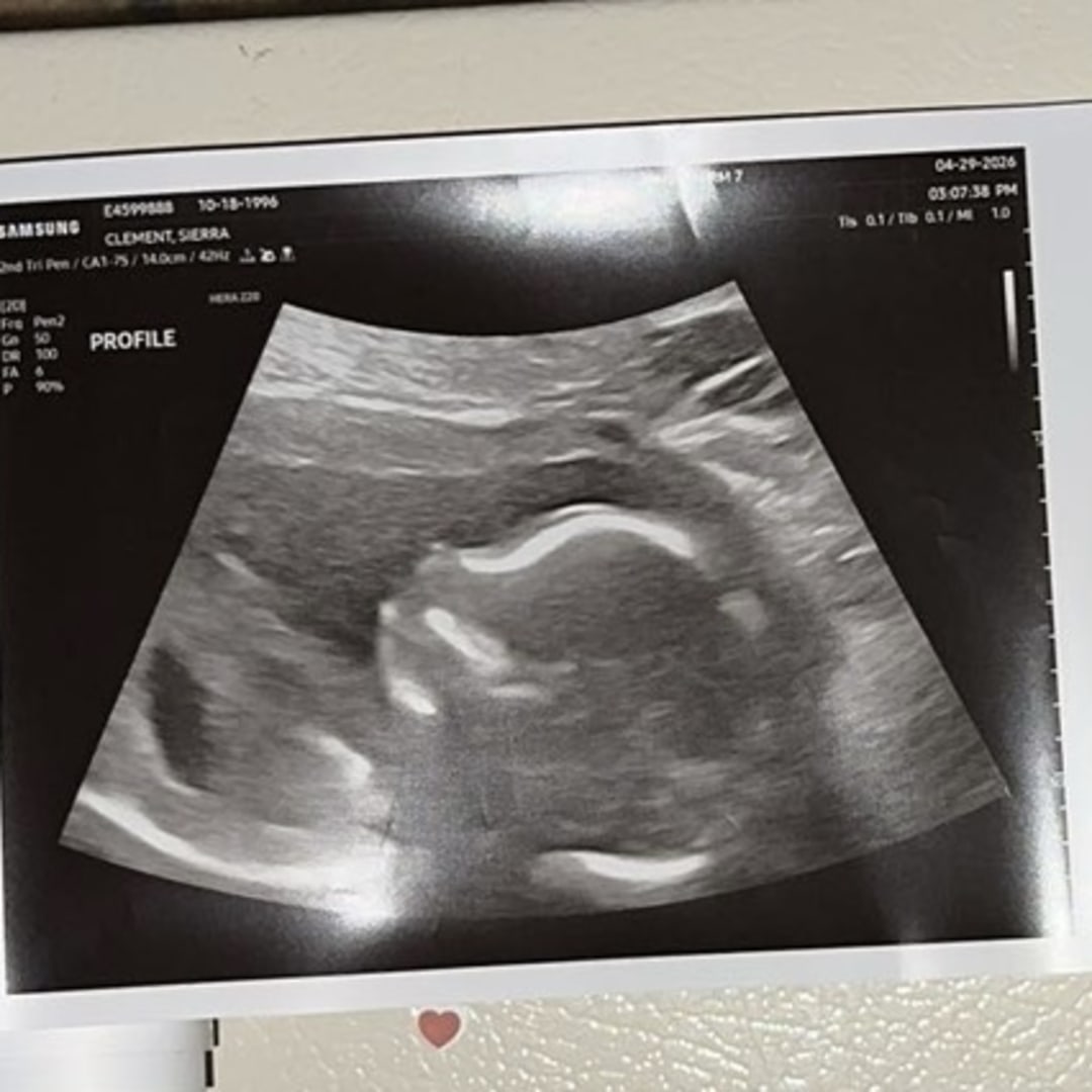 Photo shared by Sierra for their Babylist baby registry.