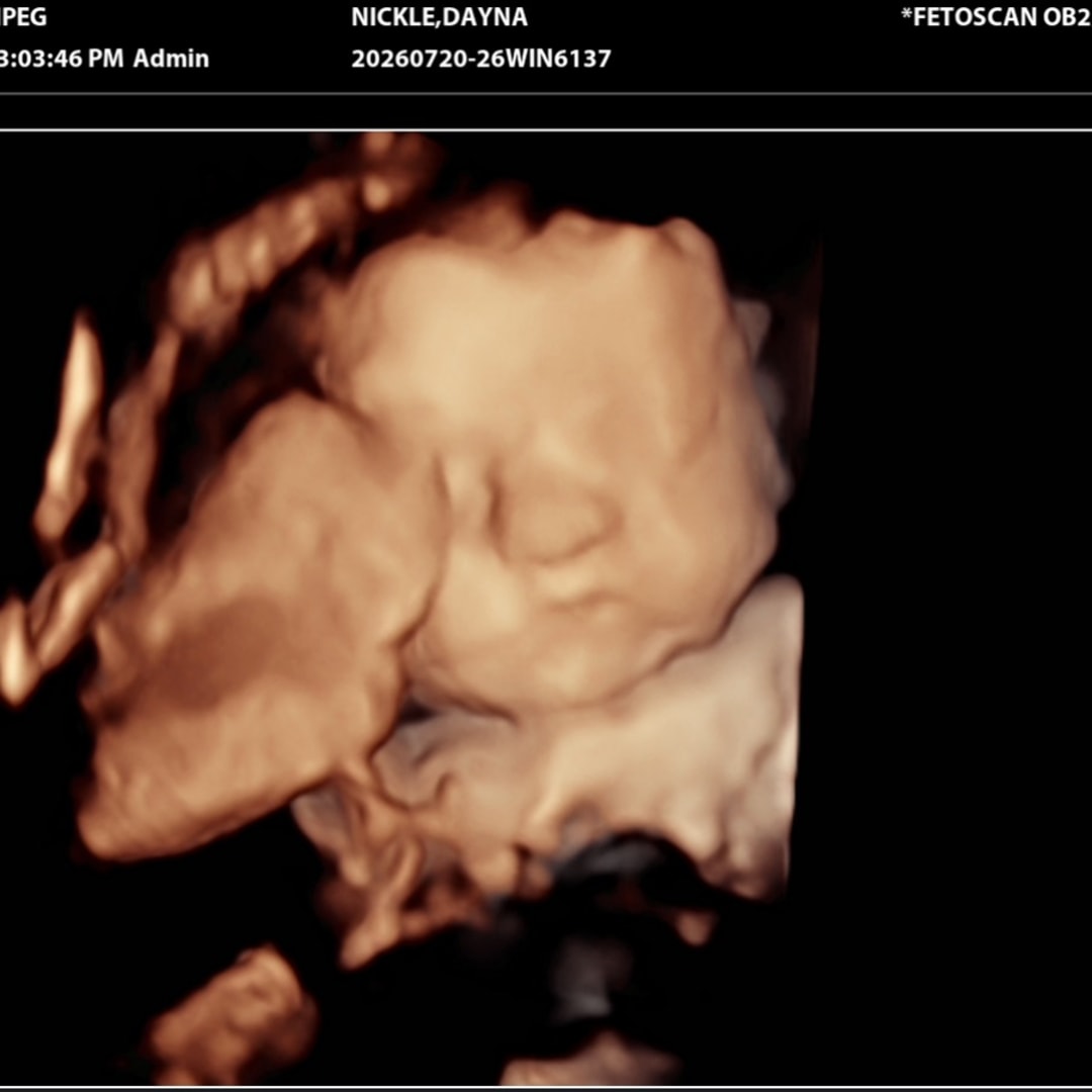 Photo shared by Dayna for their Babylist baby registry.