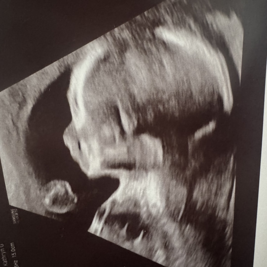 Photo shared by Grace for their Babylist baby registry.