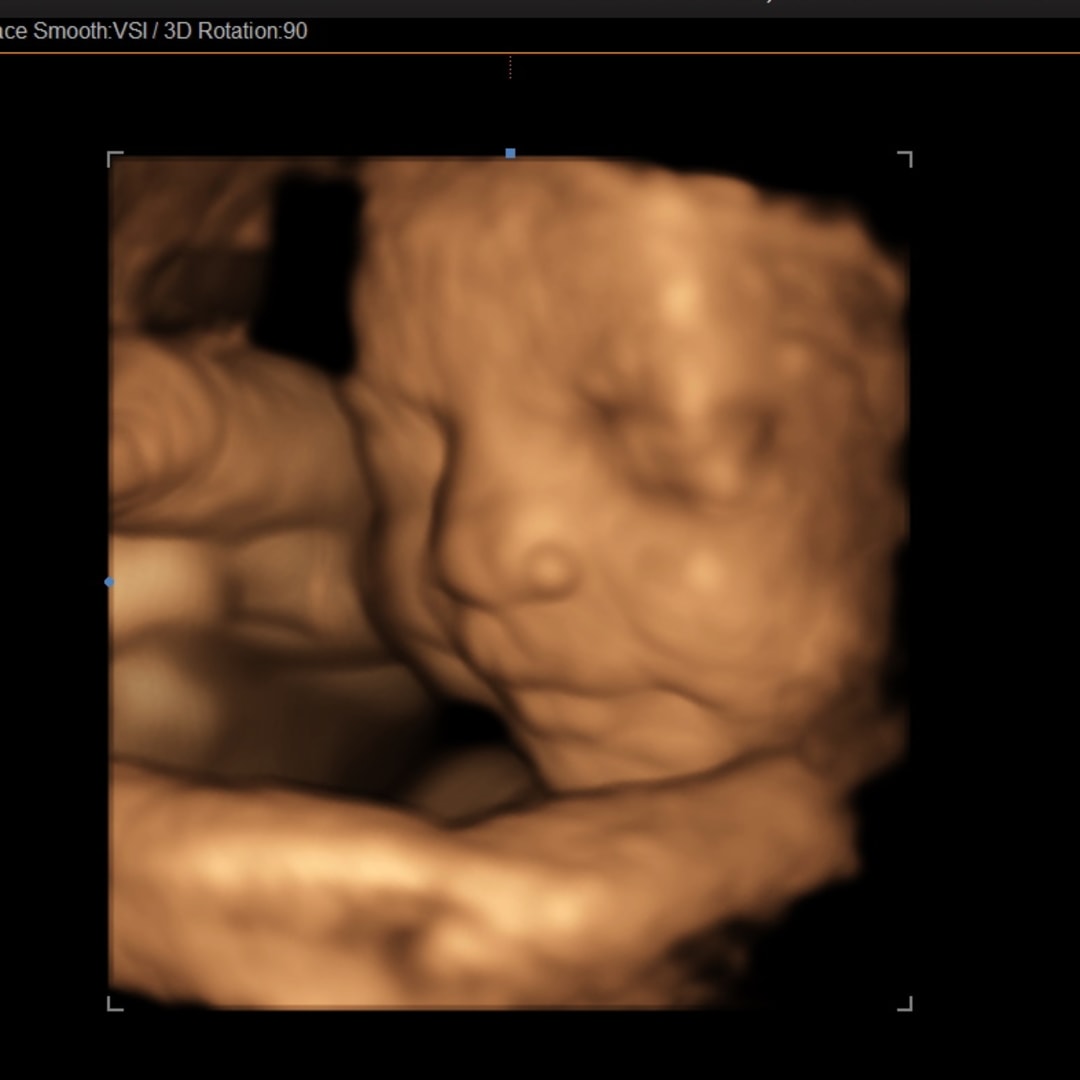 Photo shared by Ivania for their Babylist baby registry.