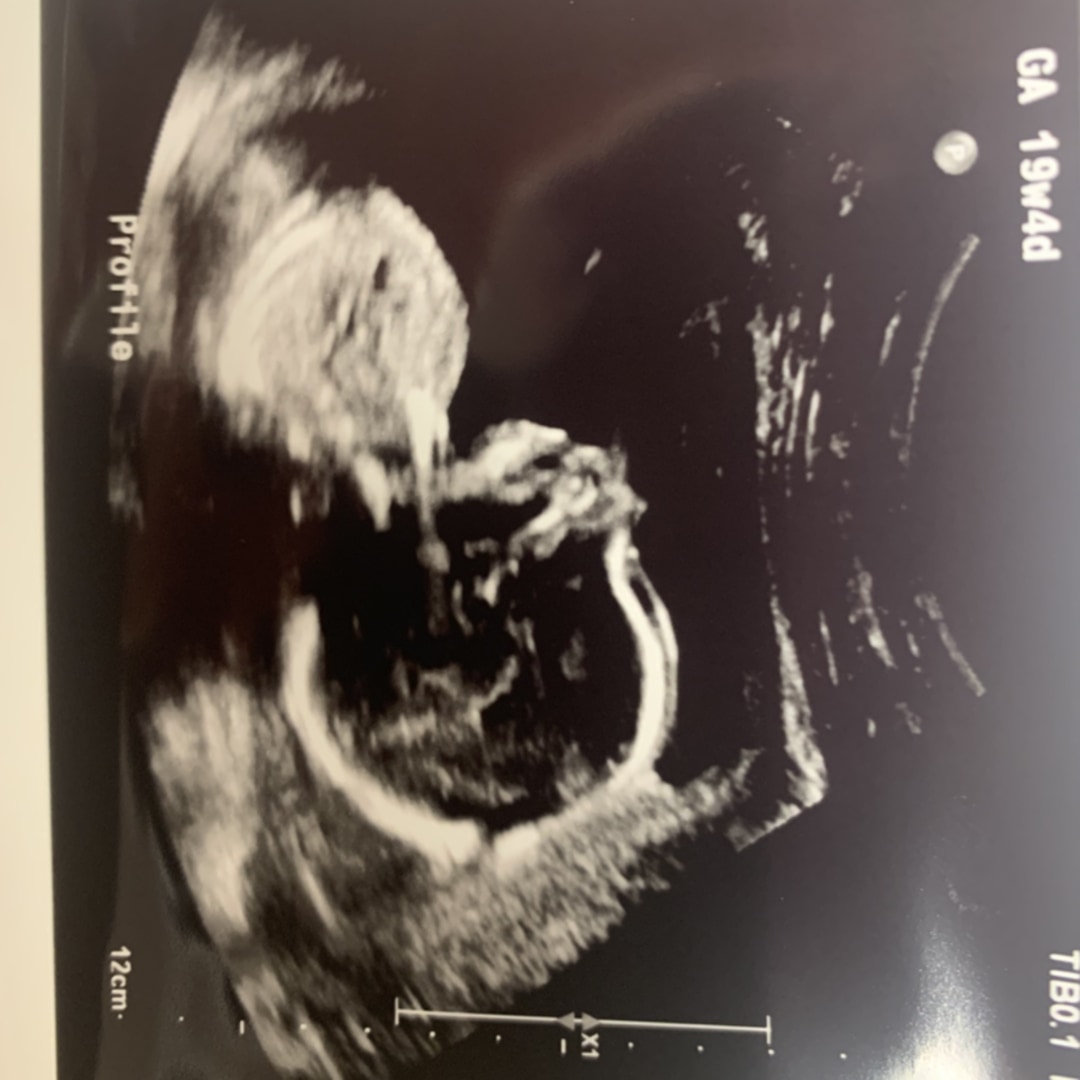 Photo shared by Athena for their Babylist baby registry.