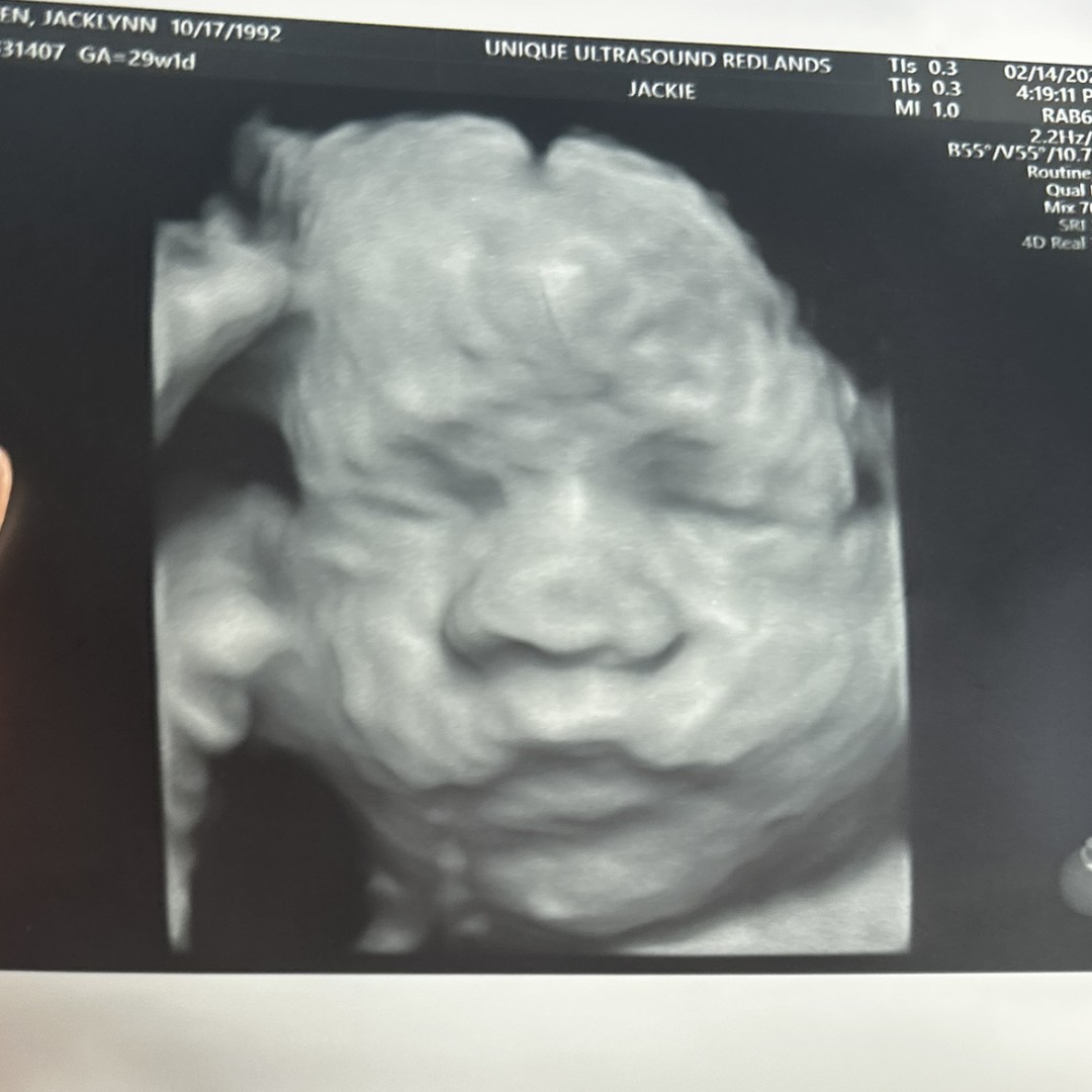 Photo shared by Jacklynn & Michael for their Babylist baby registry.