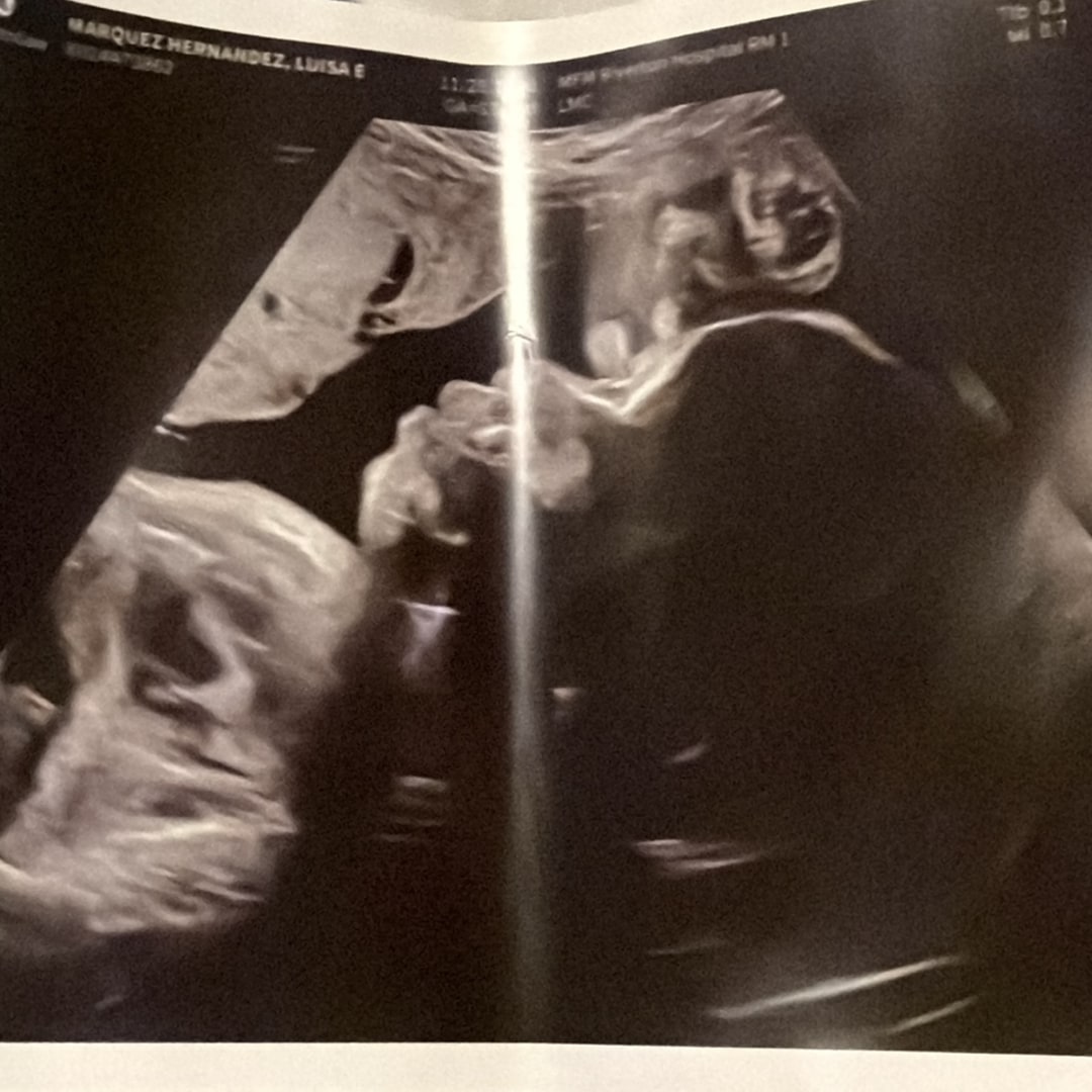 Photo shared by Luisa for their Babylist baby registry.