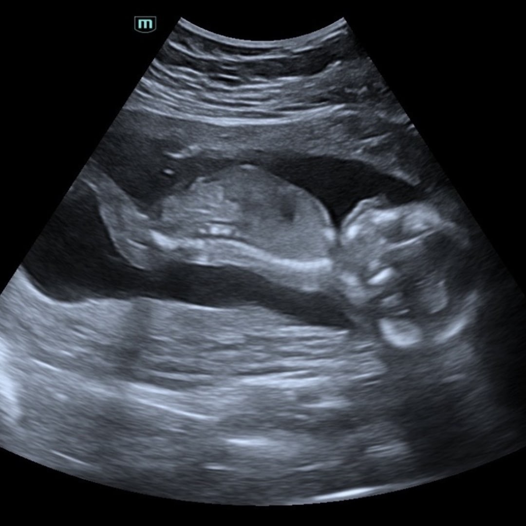 Photo shared by Katie Jo for their Babylist baby registry.
