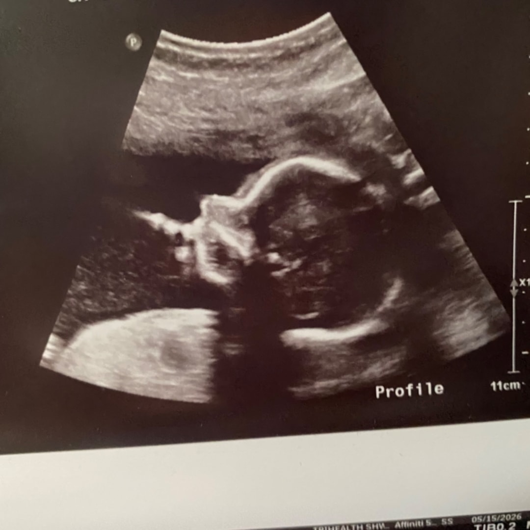 Photo shared by Adison for their Babylist baby registry.