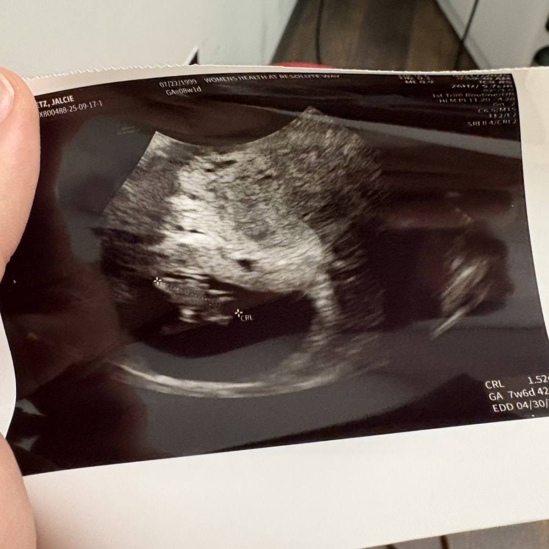 Photo shared by Jaicie for their Babylist baby registry.
