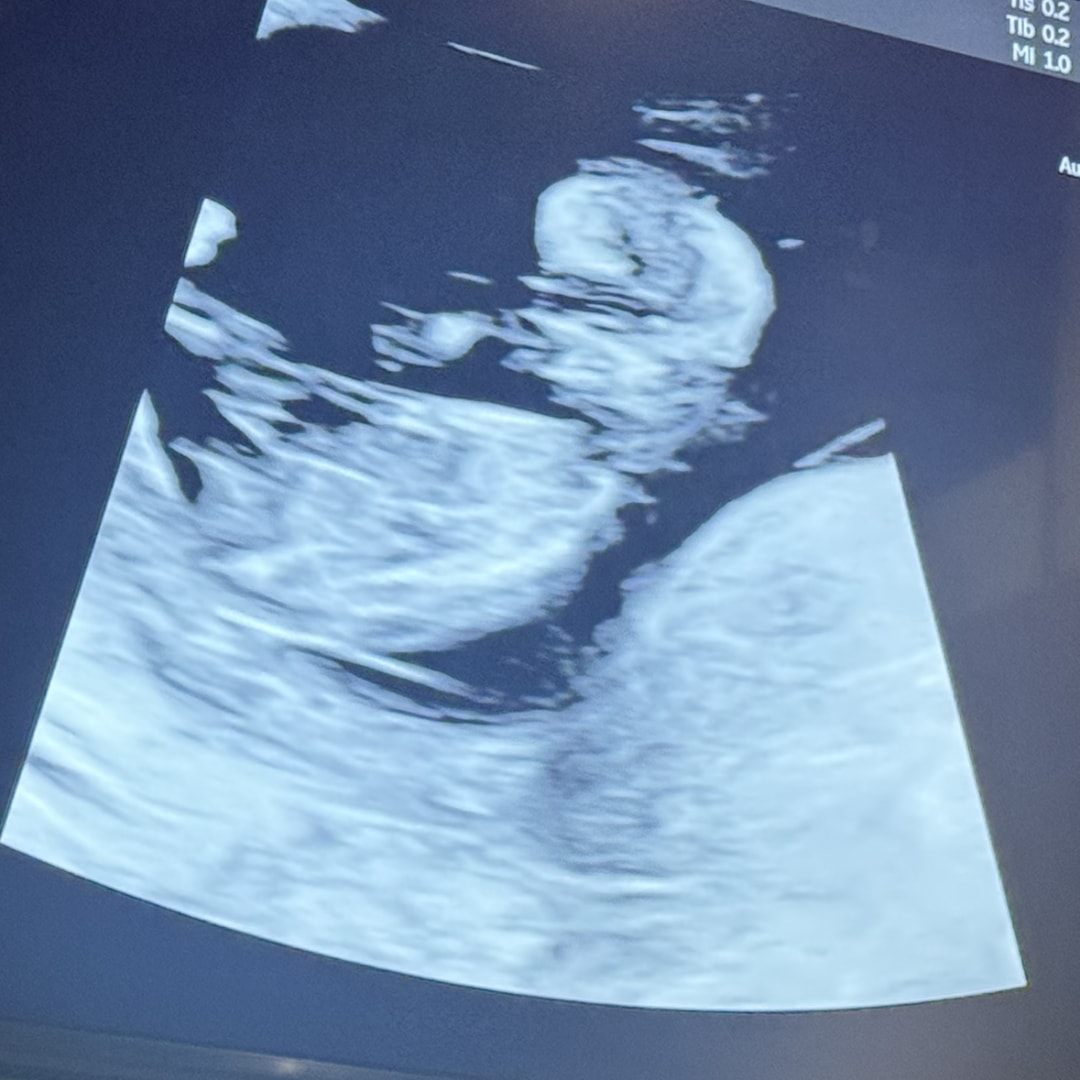 Photo shared by Sarah for their Babylist baby registry.