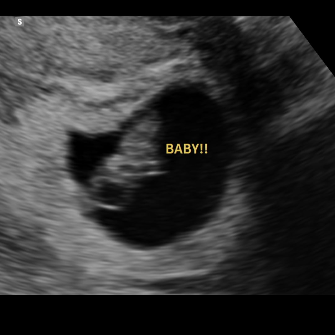 Photo shared by Braley for their Babylist baby registry.