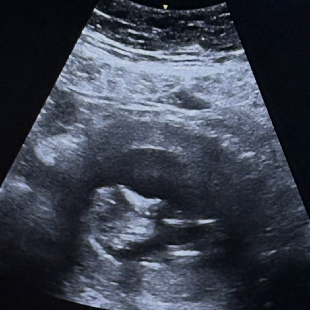 Photo shared by Brandi for their Babylist baby registry.