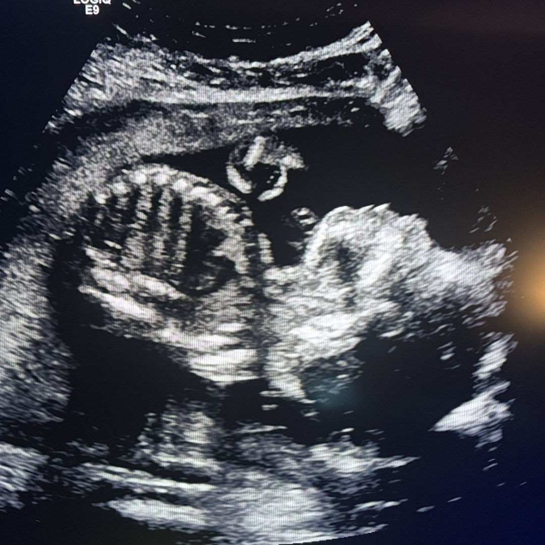 Photo shared by Brittany for their Babylist baby registry.