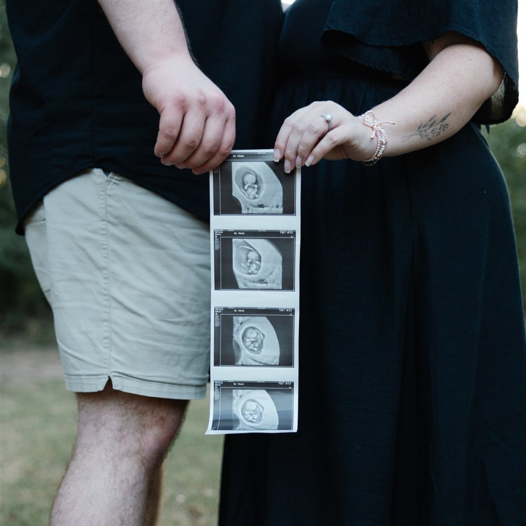 Photo shared by Chloe for their Babylist baby registry.