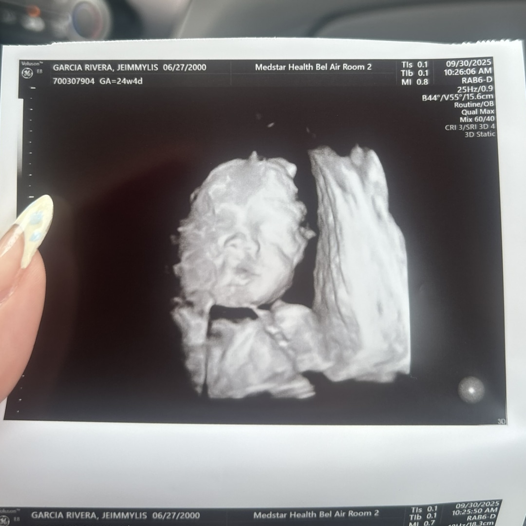 Photo shared by Jeimmylis for their Babylist baby registry.