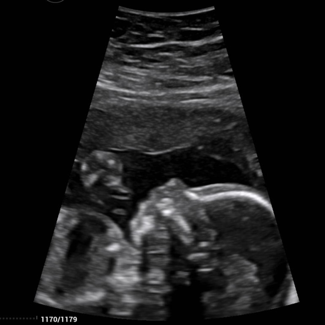 Photo shared by Emily for their Babylist baby registry.