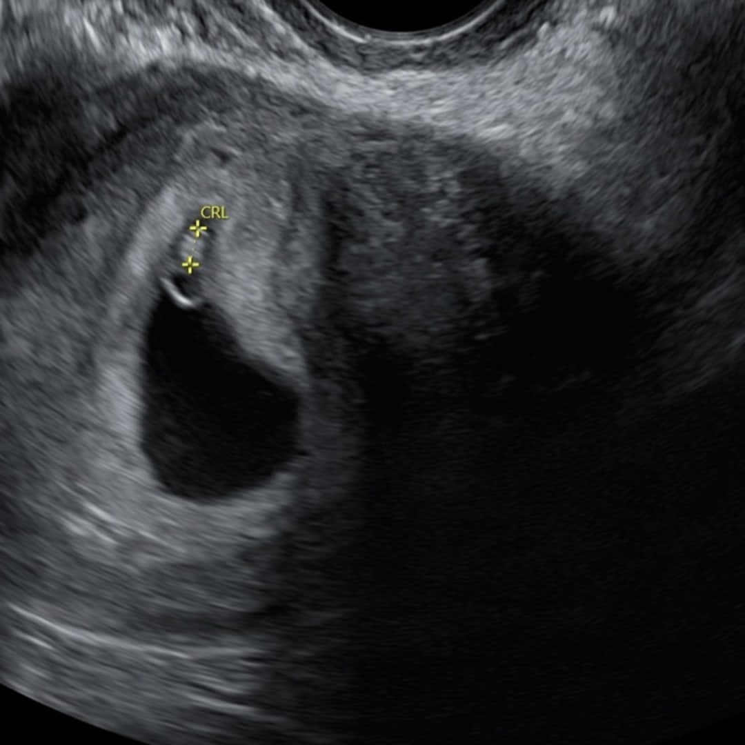 Photo shared by Tessa for their Babylist baby registry.