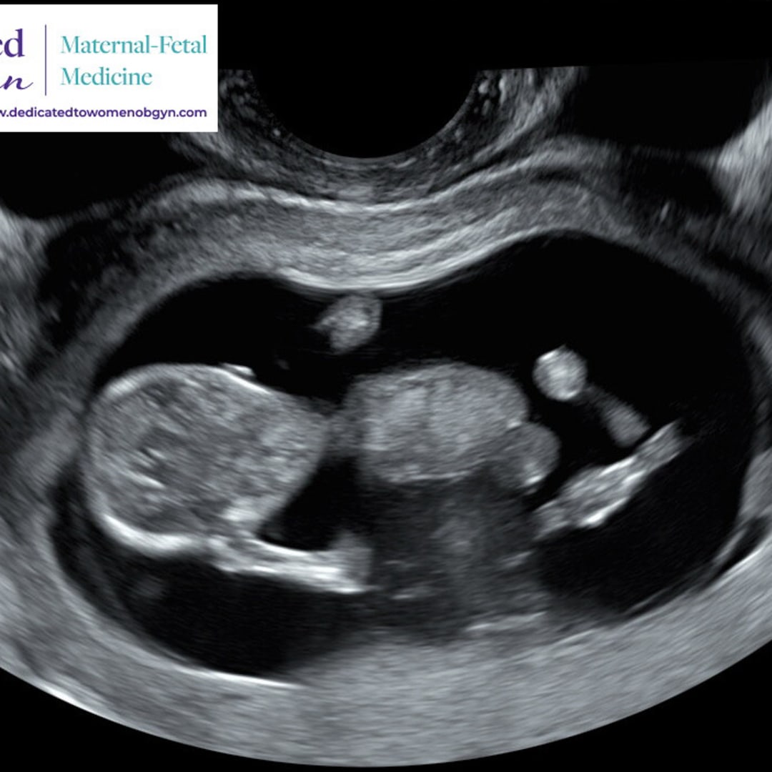 Photo shared by Gabriella for their Babylist baby registry.