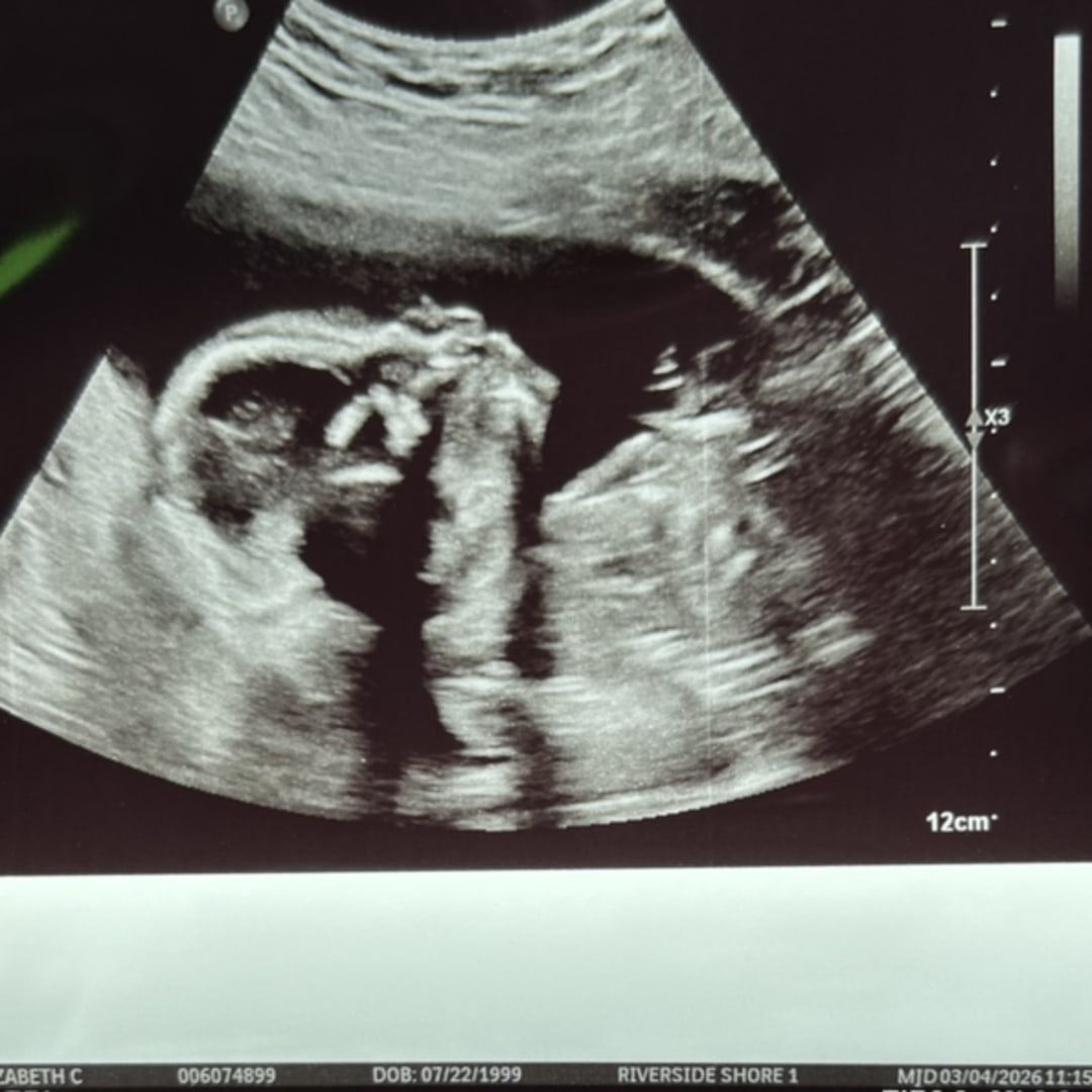 Photo shared by Liz for their Babylist baby registry.