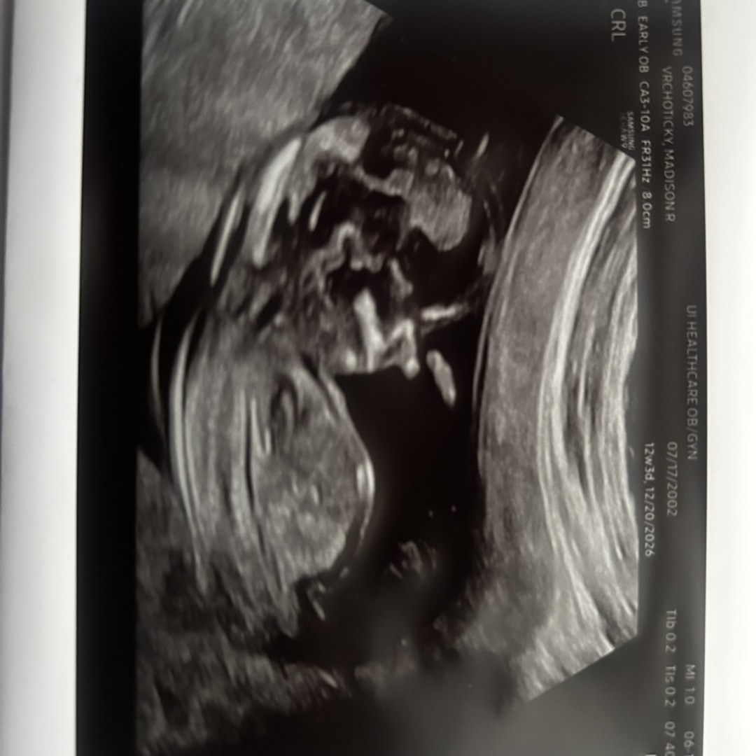 Photo shared by Madison for their Babylist baby registry.