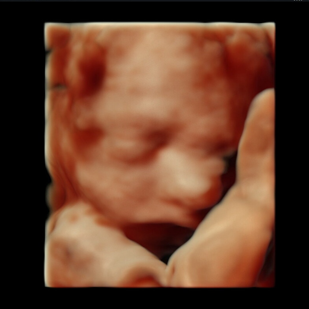 Photo shared by Erin for their Babylist baby registry.