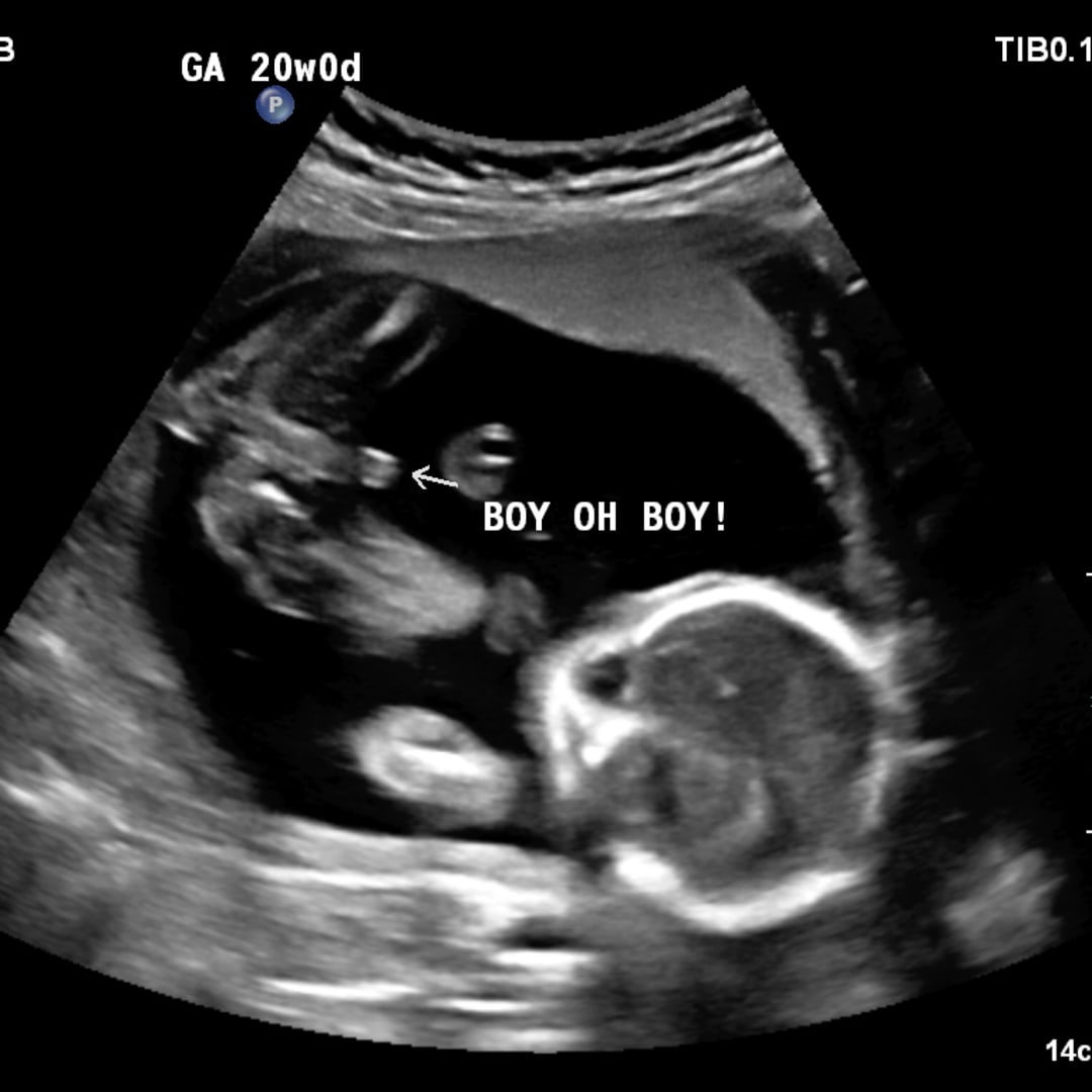 Photo shared by Demi for their Babylist baby registry.