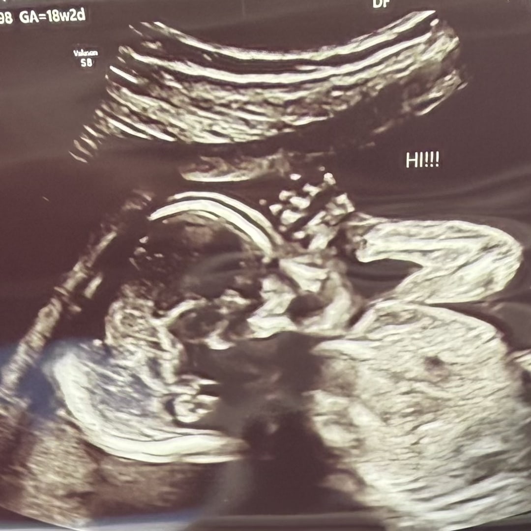 Photo shared by Karissa for their Babylist baby registry.
