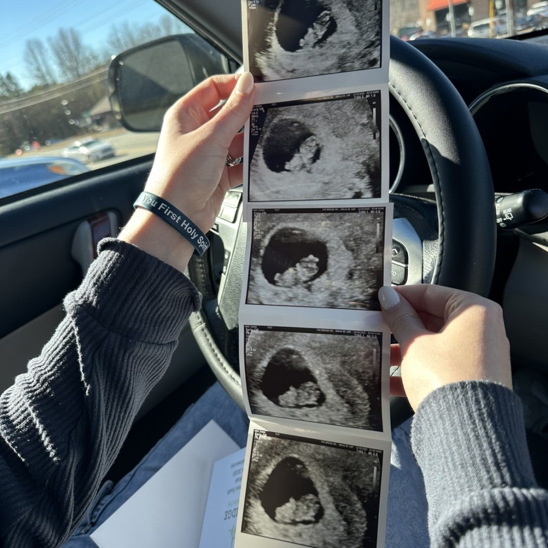 Photo shared by Emmalyn for their Babylist baby registry.