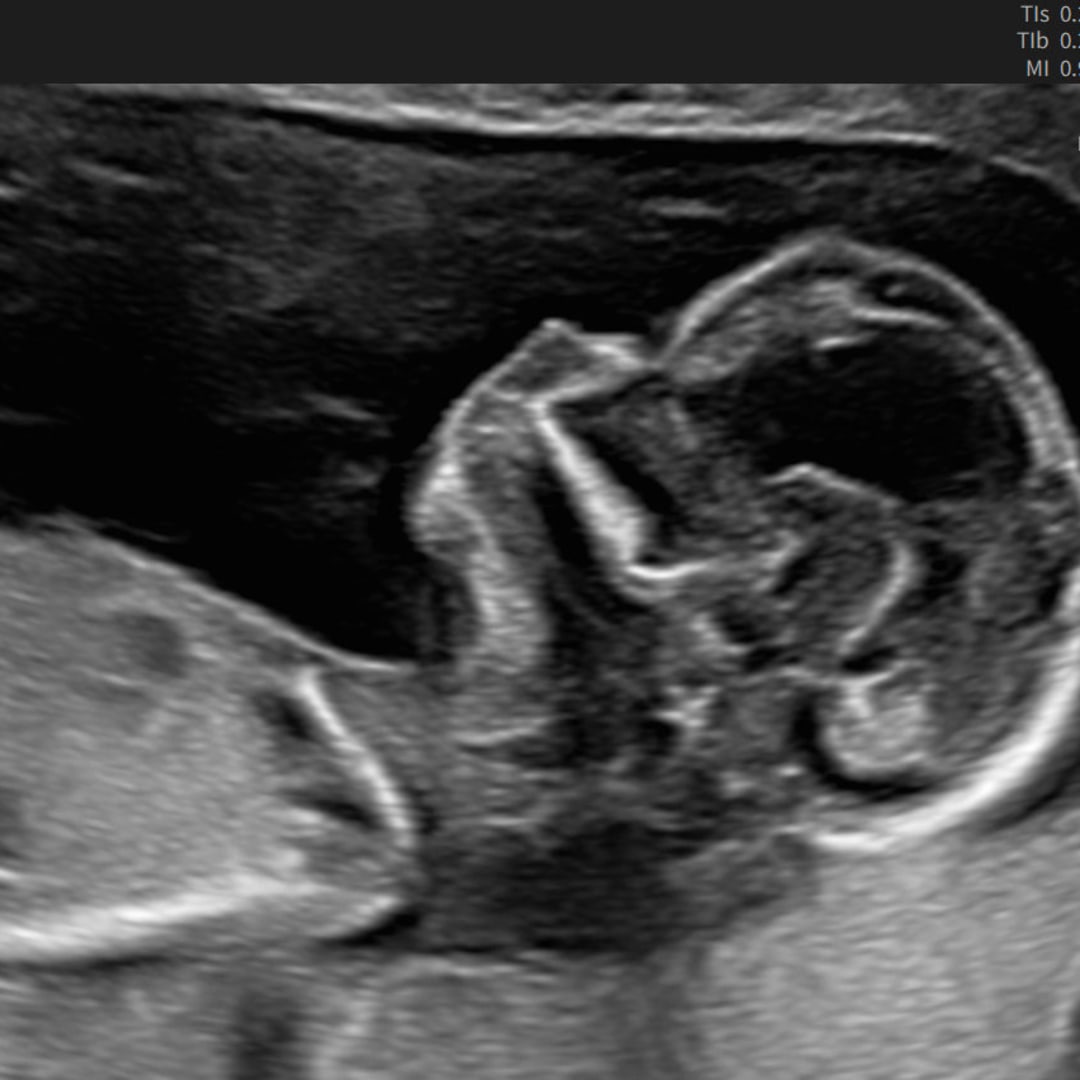 Photo shared by Mary Leah for their Babylist baby registry.