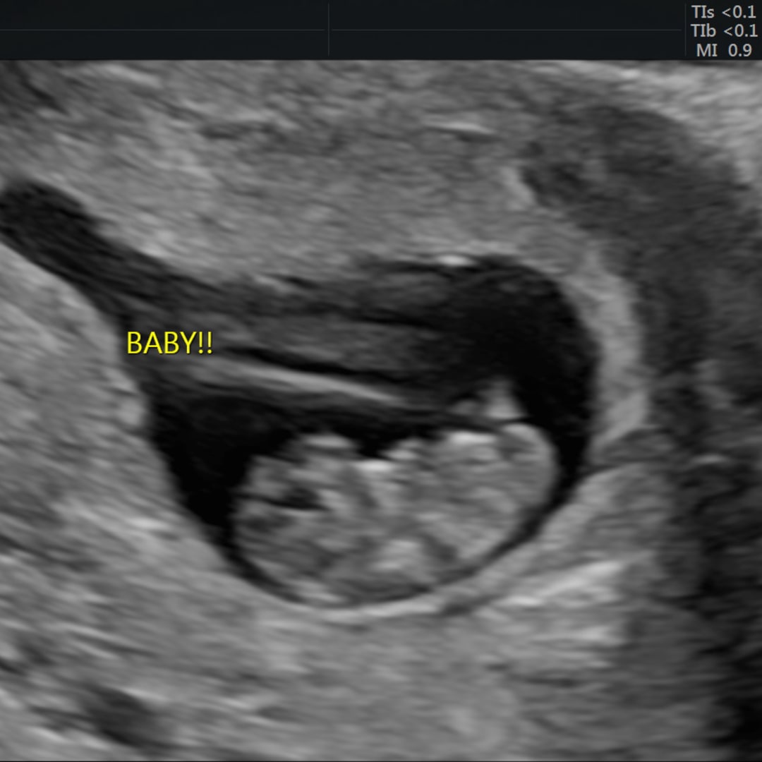 Photo shared by Destiny for their Babylist baby registry.