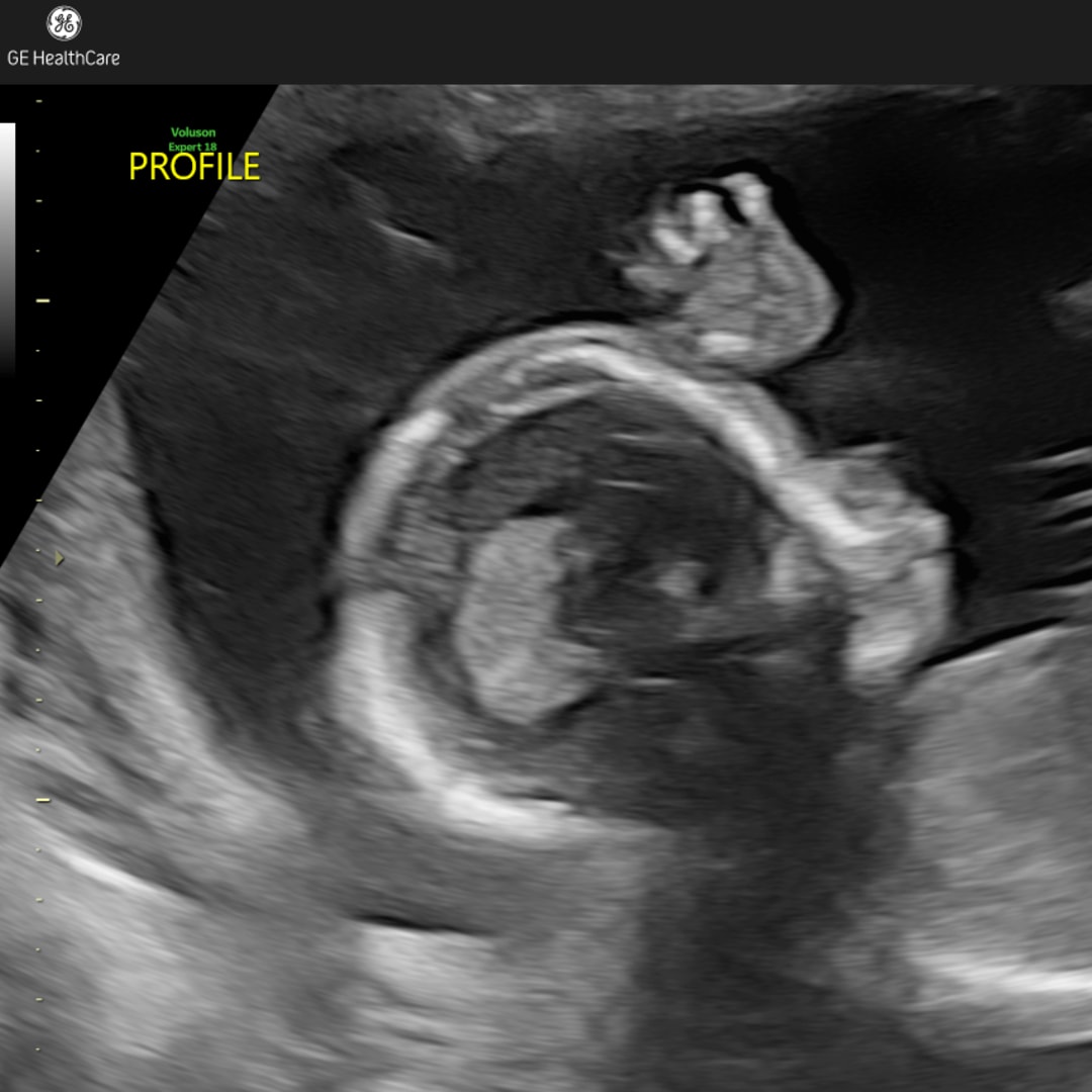 Photo shared by Patsy for their Babylist baby registry.