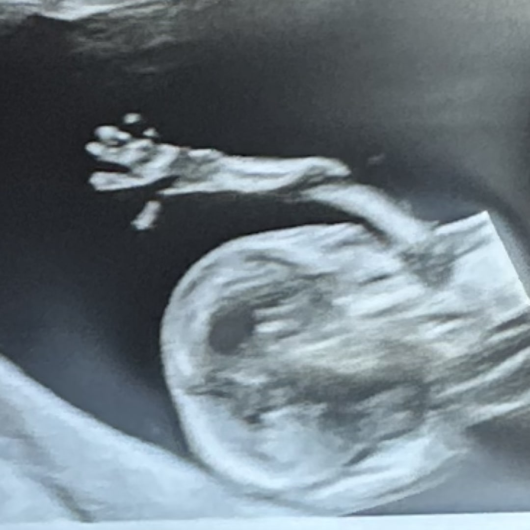 Photo shared by Brittany for their Babylist baby registry.