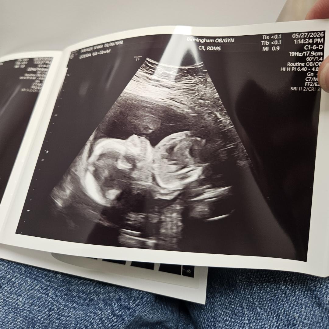Photo shared by Ryan for their Babylist baby registry.