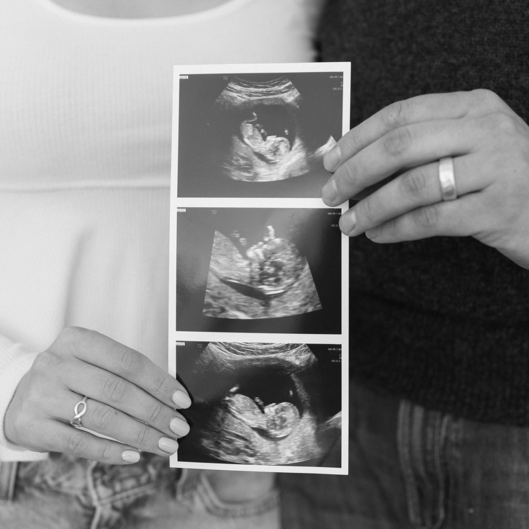 Photo shared by Emma for their Babylist baby registry.