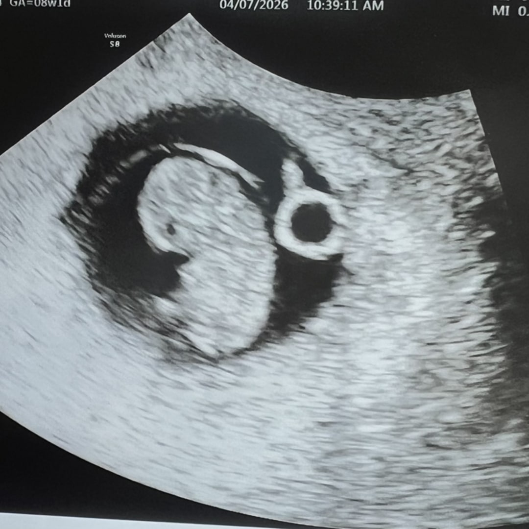 Photo shared by Angela for their Babylist baby registry.