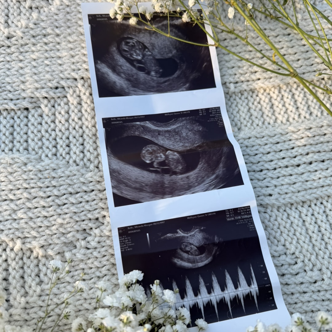 Photo shared by Miranda for their Babylist baby registry.